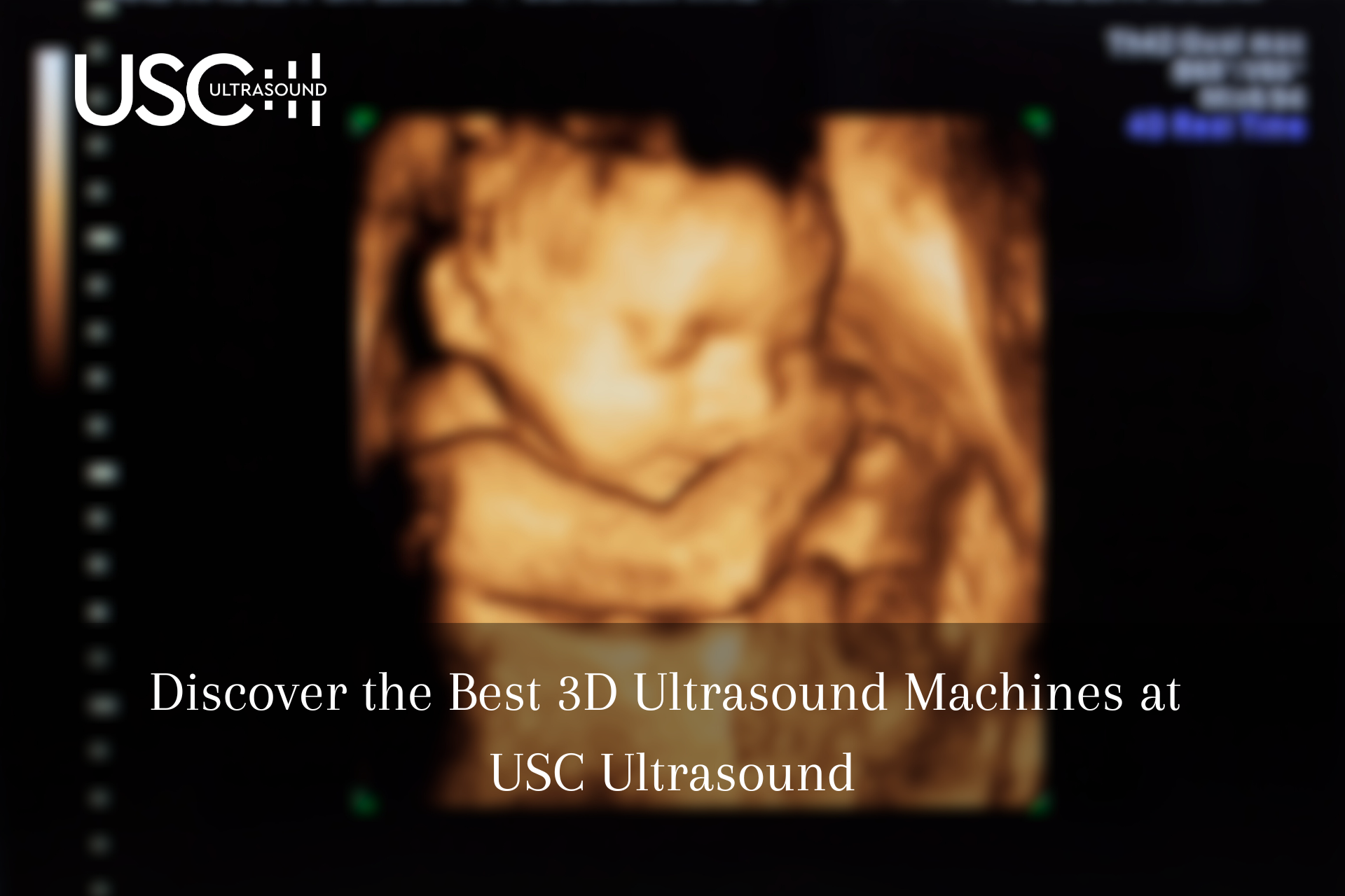 3D Ultrasound Machine purchase